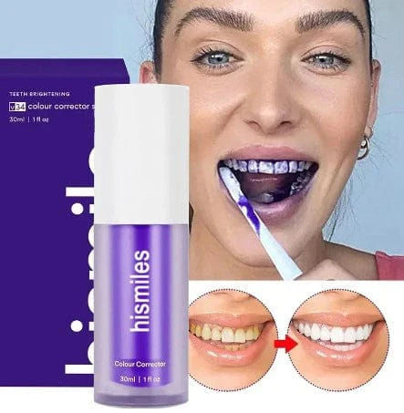 Hismile®  v34